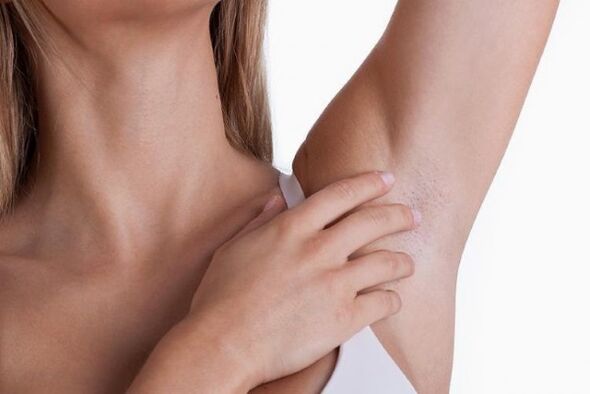 papillomas under the armpits of a woman