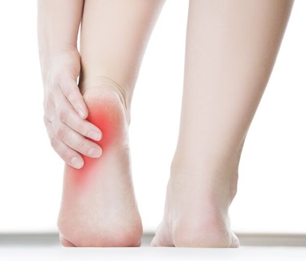 A wart on the heel causes severe pain